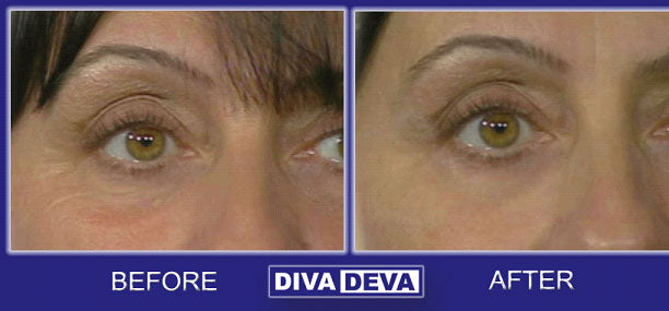 Reverse Instant Wrinkle Remover